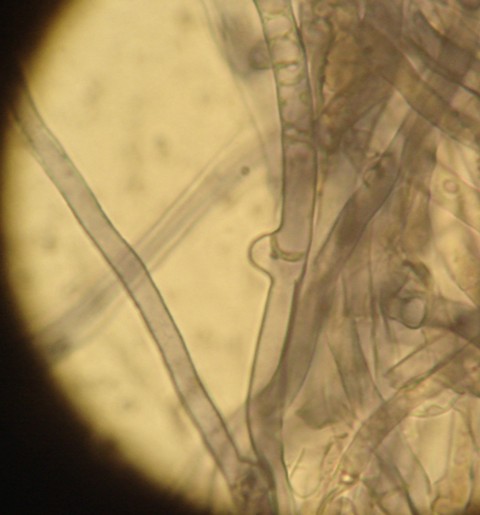 Pulcherricium caeruleum (Terana caerulea)